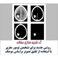پردازش تصویر,مقاله پیاده سازی شده,مقاله پیاده سازی شده با متلب : تشخیص تومورهای مغزی با استفاده از موجک